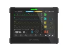 AIVIEW VX betegellenőrző monitor