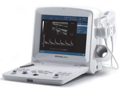 Ultrahang készülék, hordozható EDAN DUS60 / Ultrasound DUS60 konvex fejjel