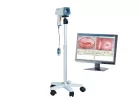 KN-2200 /monitoros / videó Kolposzkóp