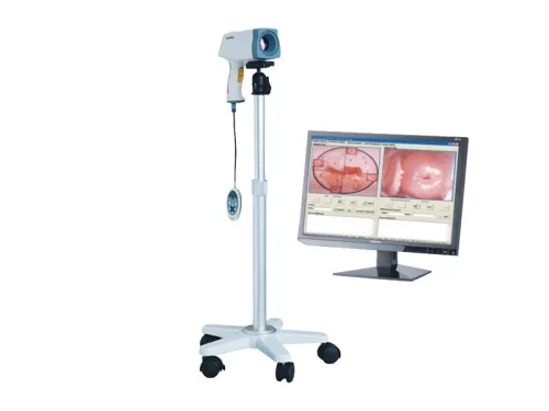 KN-2200 /monitoros / videó Kolposzkóp
