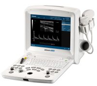 Ultrahang készülék, hordozható EDAN DUS60